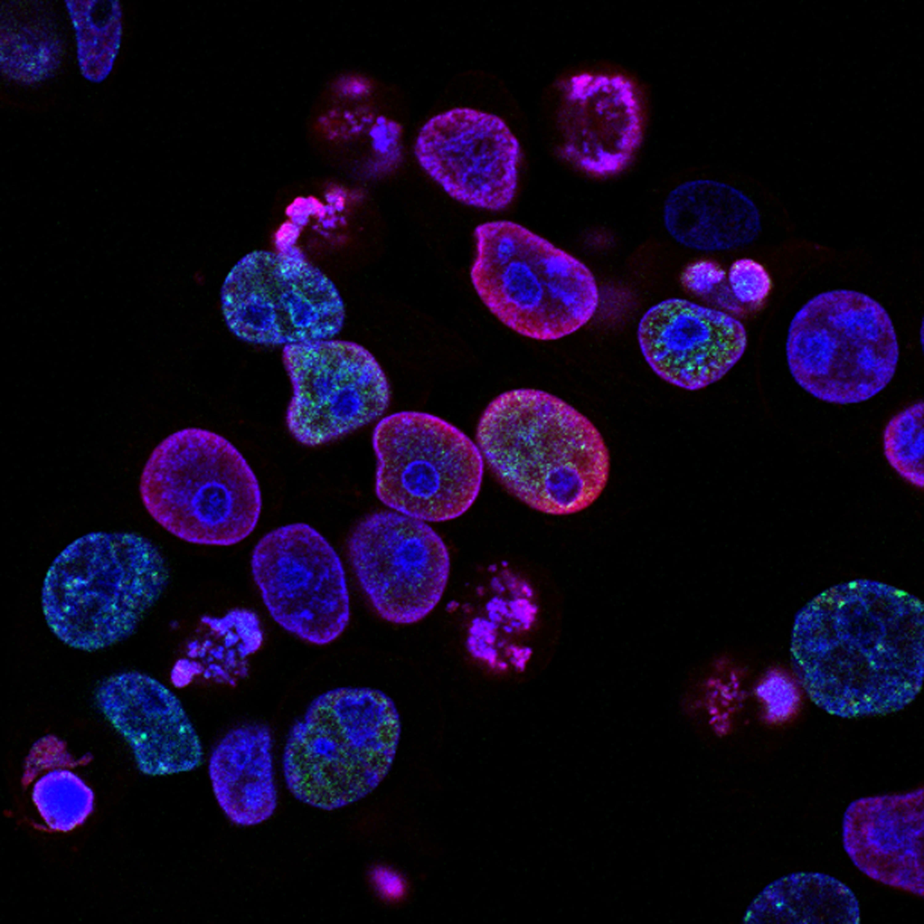 purple cells glowing lurid on a black background. The photo sits in front of another, fullscreen, image of purple clustered cells